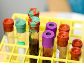 Miniatura: Nowa nadzieja dla 21 mln Polaków....