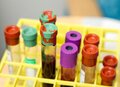 Miniatura: Nowa nadzieja dla 21 mln Polaków....