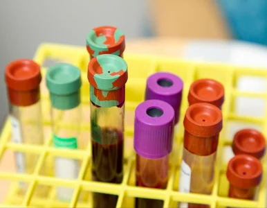 Miniatura: Nowa nadzieja dla 21 mln Polaków....